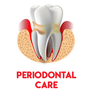 Periodontal care | Smile Select Dental