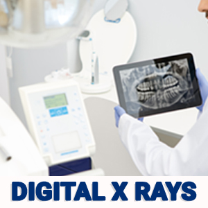 Digital X rays | Smile Select Dental