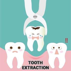 extractions-emergency-dentistry